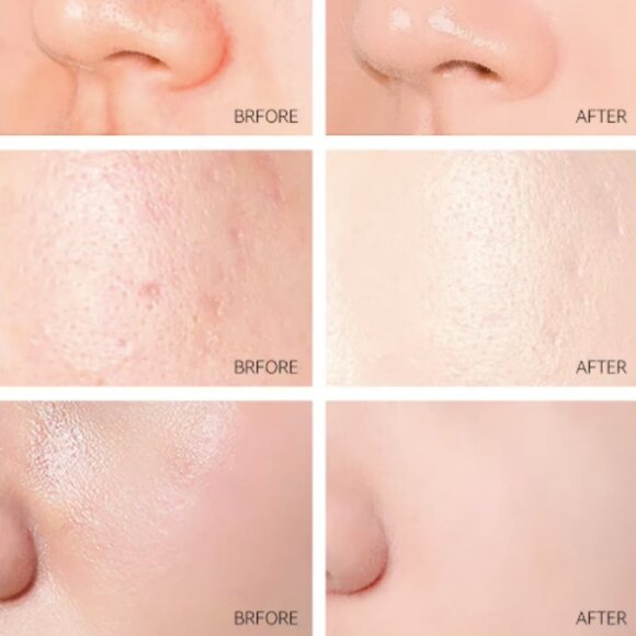 LAIKOU 24K Gold Sakura Peeling Face Mask AntiWrinkle Whitening Blackhead Removal - Picture 6 of 15